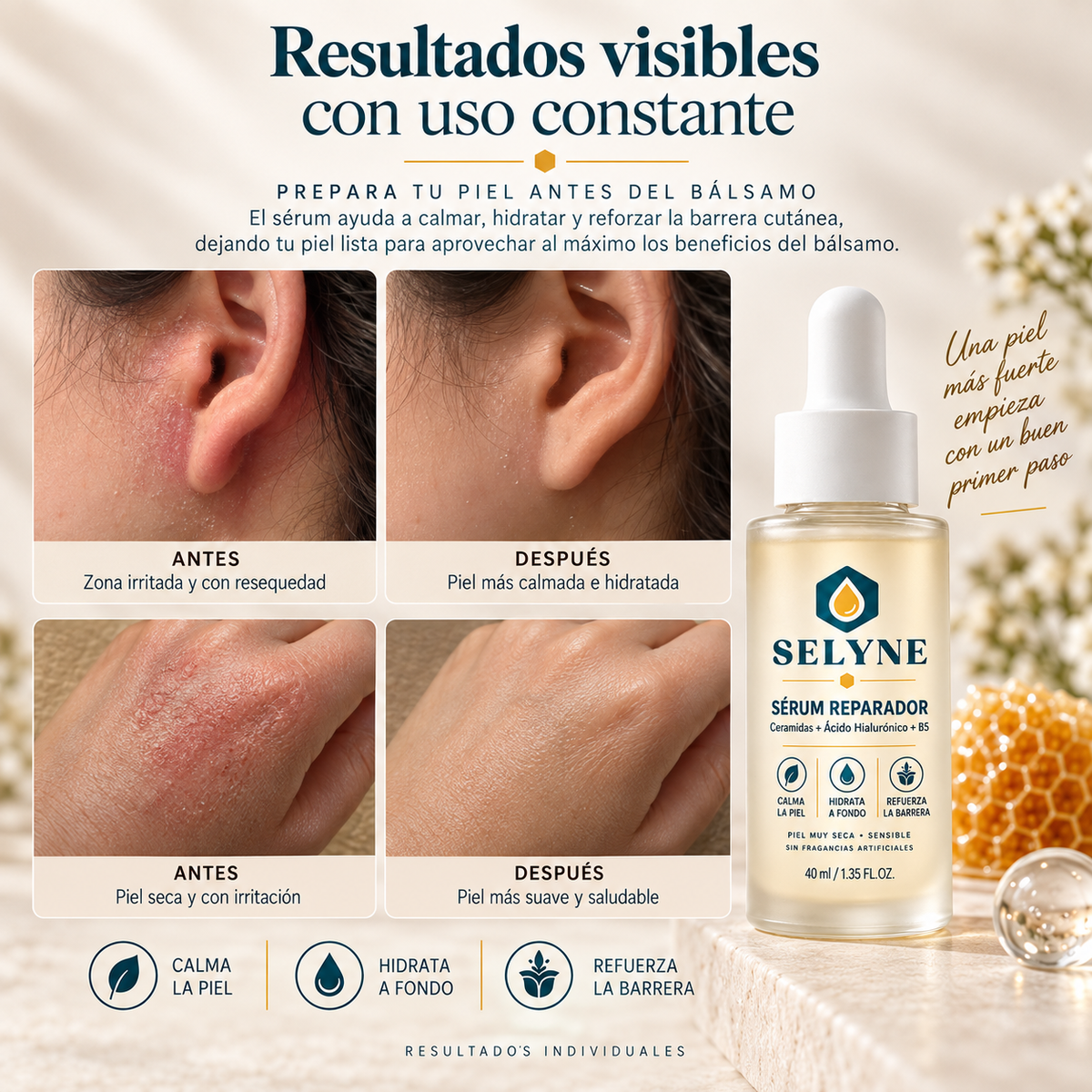Sérum Reparador y calmante SELYNE®