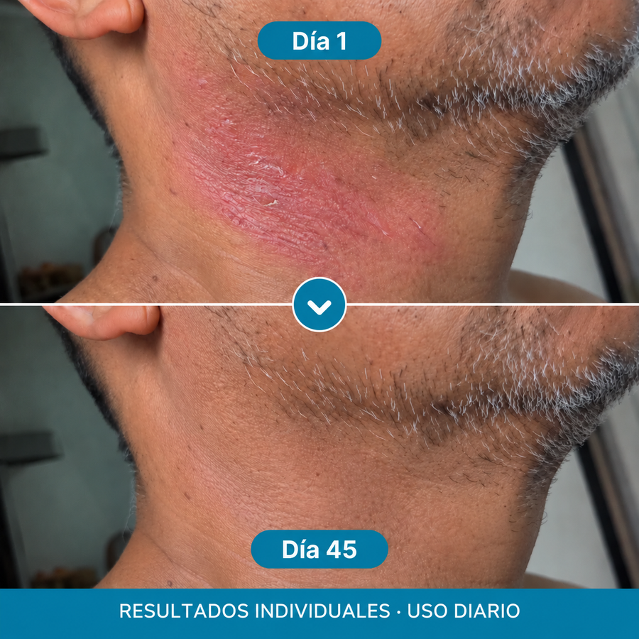 Cuidado facial para piel sensible