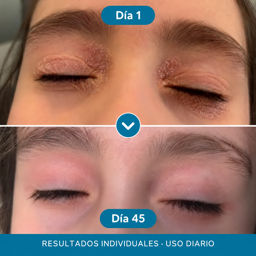 Cuidado de piel sensible